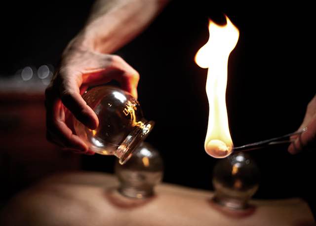 CUPPING