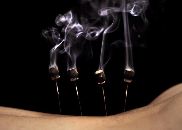 MOXIBUSTION